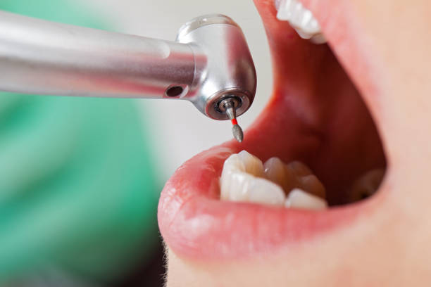Best Root Canal Emergency Dentist  in Gladwin, MI